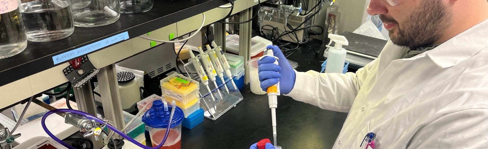 Castration Resistant Cancer Cells Lab Work 