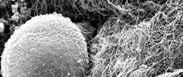 Bladder Cells Close Up