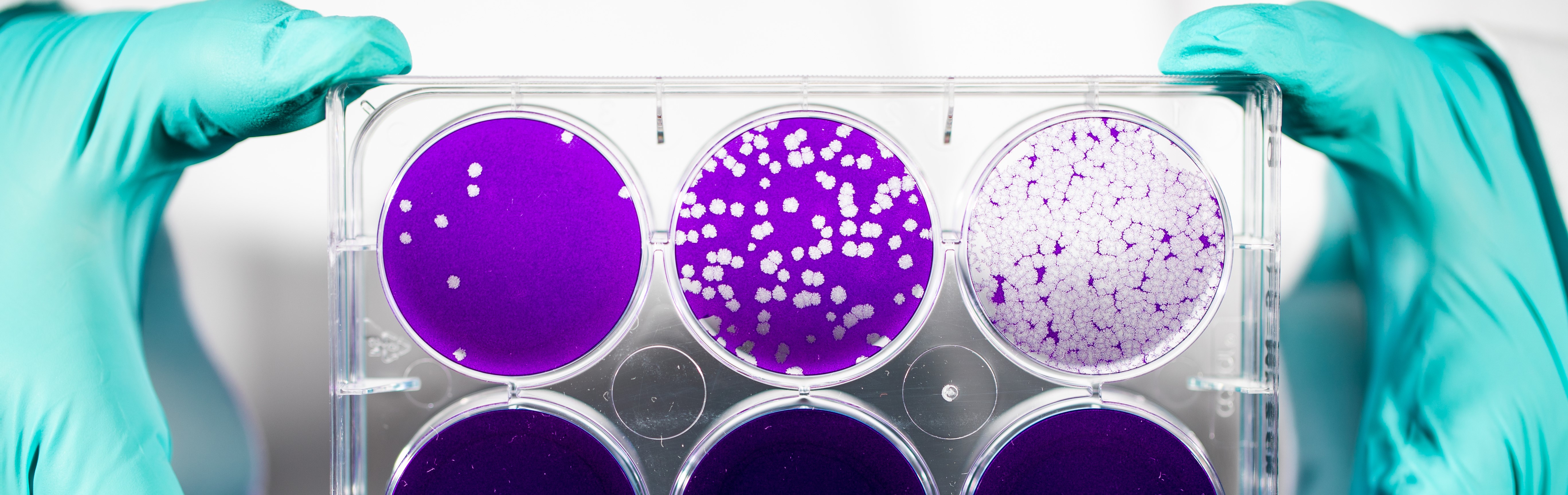 Immunology